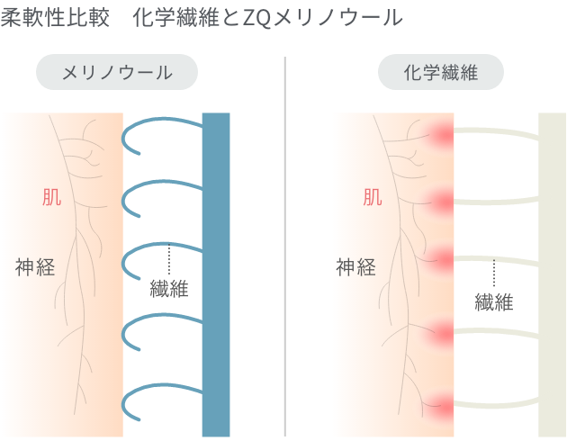 記事の糸の先が丸くなっている図